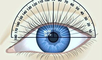 Astigmat tedavisi Mümkün mü? Gözlük takılmazsa ne olur?
