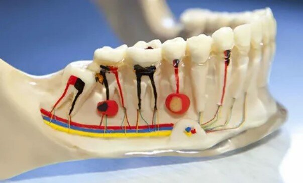 Aynı Dişe 2 Kez Kanal Tedavisi Yapılır mı