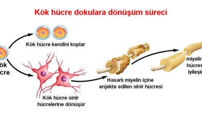 Kök Hücre Tedavisi Ömrü Ne Kadardır?