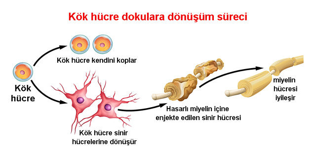 Kök Hücre Tedavisi Ömrü Ne Kadardır?