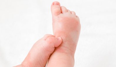Bebeklerde Alerji Belirtileri Nedir, nasıl anlaşılır?